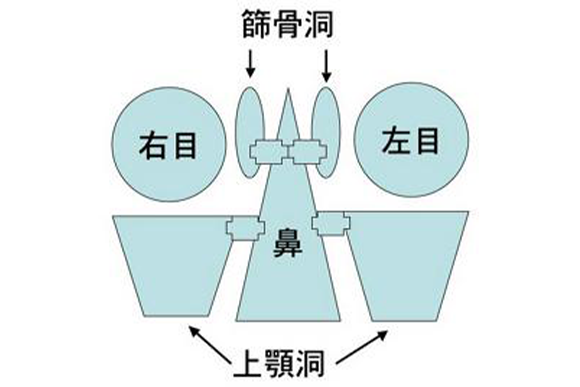 副鼻腔炎